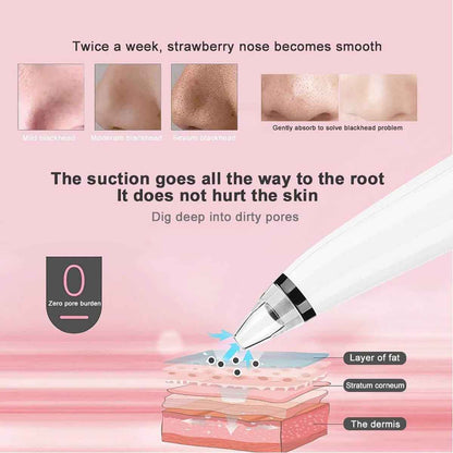 Blackhead Remover Vacuum Machine Device Electronic Skin Care Health